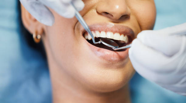 Best Emergency Root Canal Treatment in Santa Moni, CA