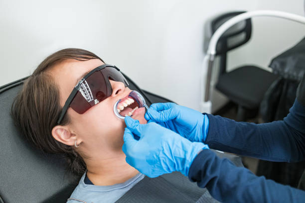 Best Emergency Wisdom Teeth Removal in Santa Moni, CA